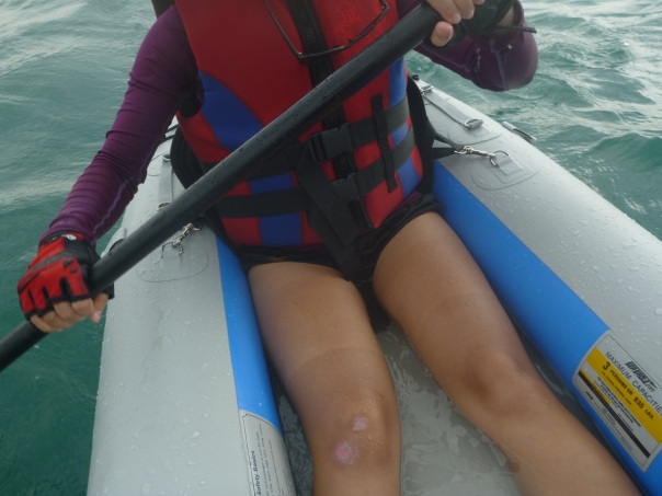 Stephanie's legs showing what it takes to be an outdoor girl! Tan lines and scars, and sitting in a boat full of water as we paddle hard to make Tekukor Island.