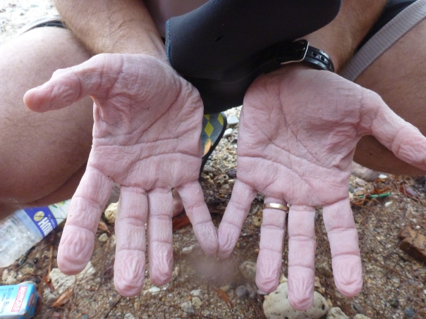 My hands after 5 hours immersed in water.